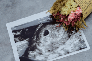 エコー写真-で作る世界に一つの-エコーポスター-出産祝い-や-赤ちゃんの記念に-BANK-OF-MEMORIES-10-28-2025_09_42_PM