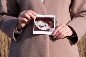 エコー写真-で作る世界に一つの-エコーポスター-出産祝い-や-赤ちゃんの記念に-BANK-OF-MEMORIES-10-28-2025_09_43_PM3